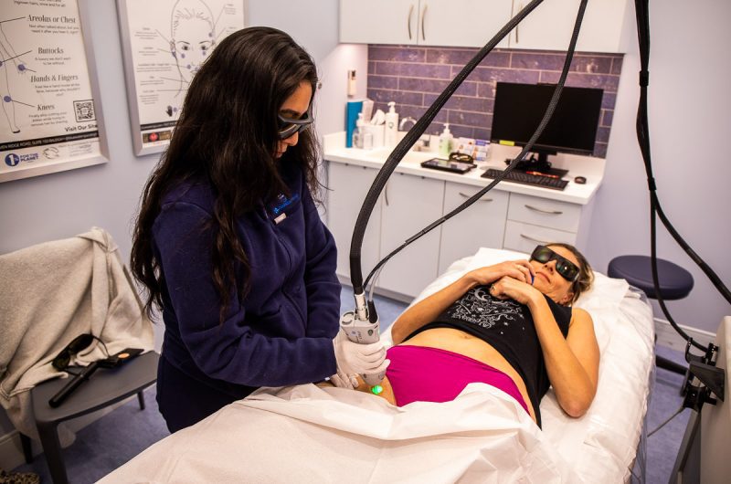 Lady receiving hair laser treatment near bikini line